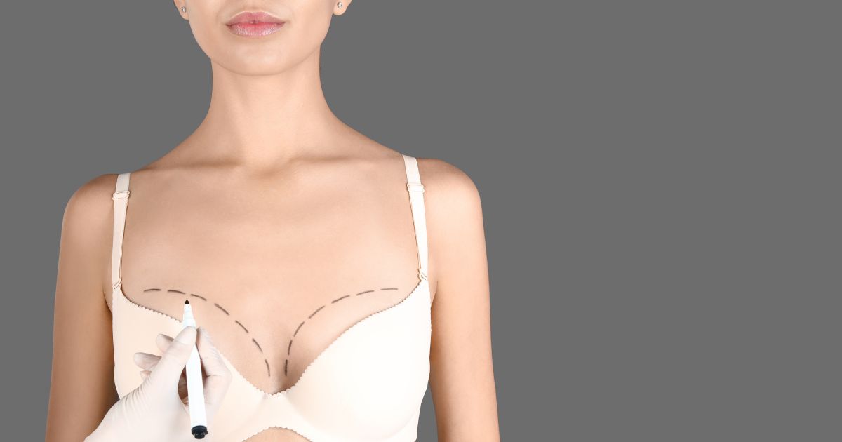 Breast Lift And Bra Fitting