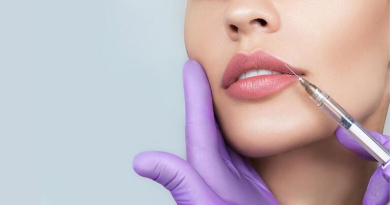 Busting Myths About Lip Fillers
