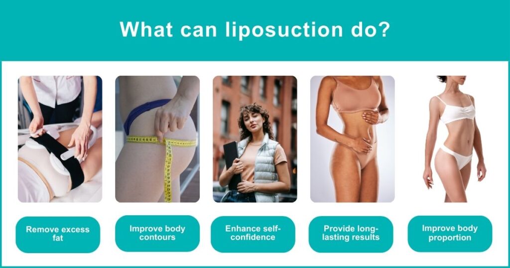 Managing Expectations_ What Liposuction Can And Cannot Do