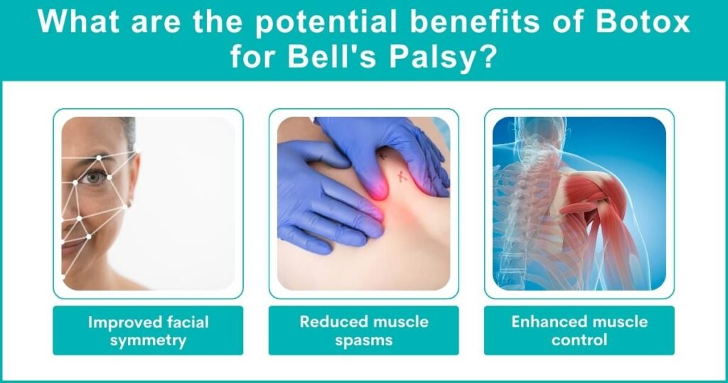 Potential Benefits Of Botox For Bell'S Palsy?