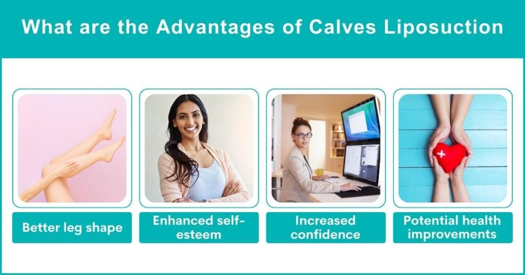 Benefits Of Calves Liposuction In Dubai