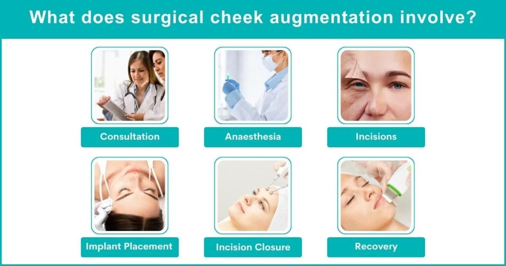 What Does Surgical Cheek Augmentation Involve?