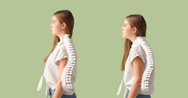 How A Tummy Tuck Can Improve Your Posture