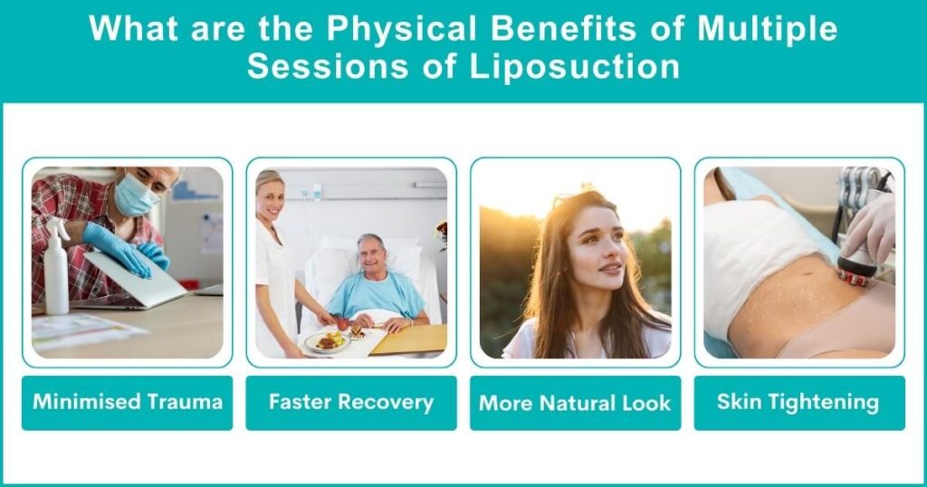 Physical Benefits Of Multiple Sessions Of Liposuction