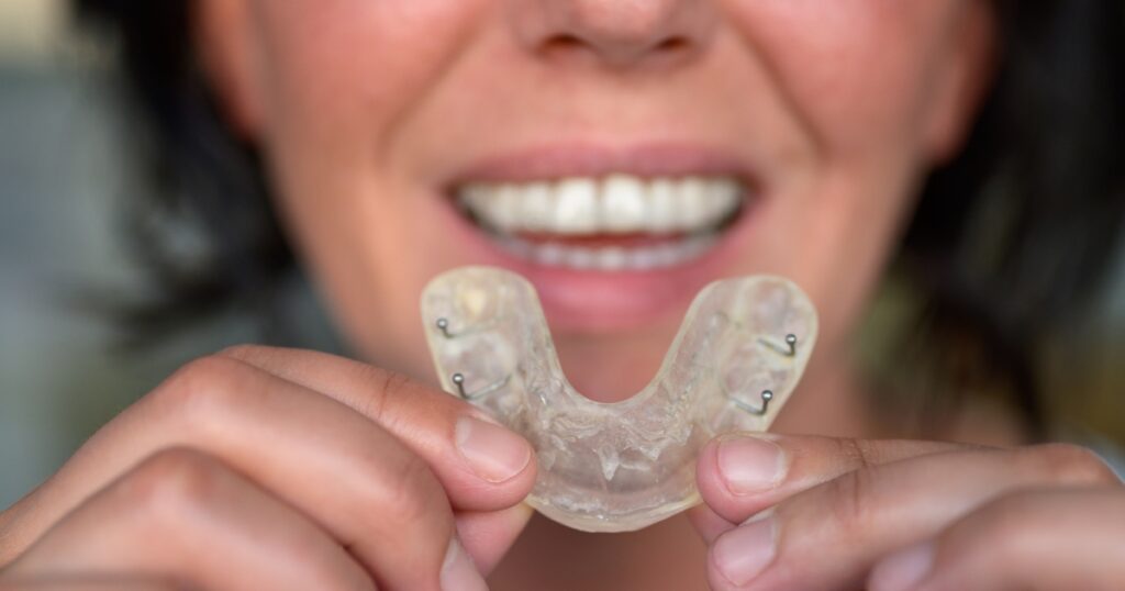 Exploring Different Treatment Options For Bruxism