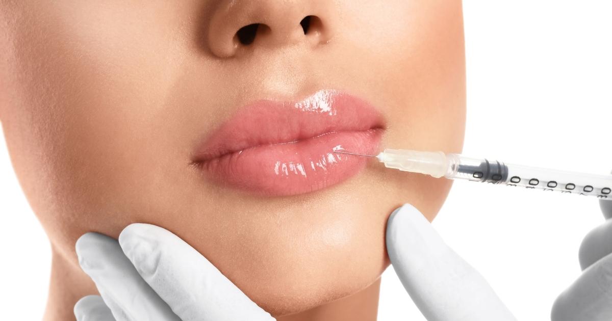 Lip Fillers Or Lip Implants - Making The Right Choice