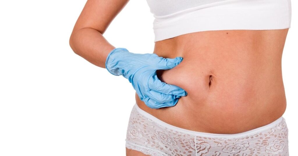 Liposuction Before Pregnancy_ Possible Impacts On Fertility