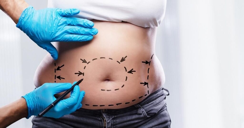The Medical Risks Of Liposuction In Adolescence