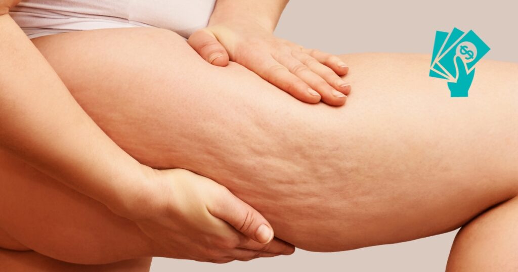 Thigh Liposuction Cost In Dubai