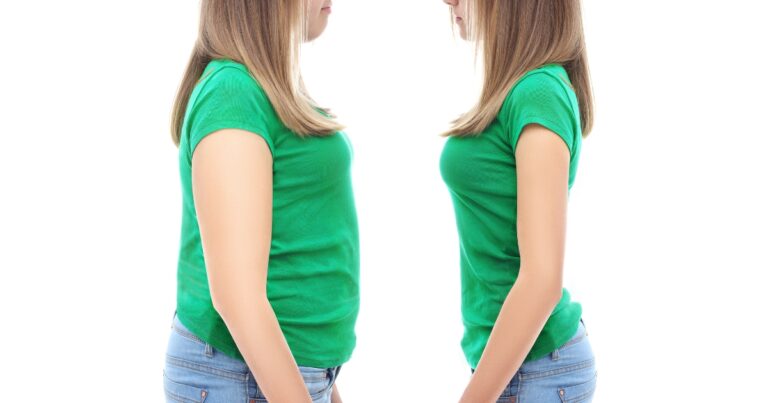 Tummy Tuck Vs. Natural Weight Loss: A Comparative Study