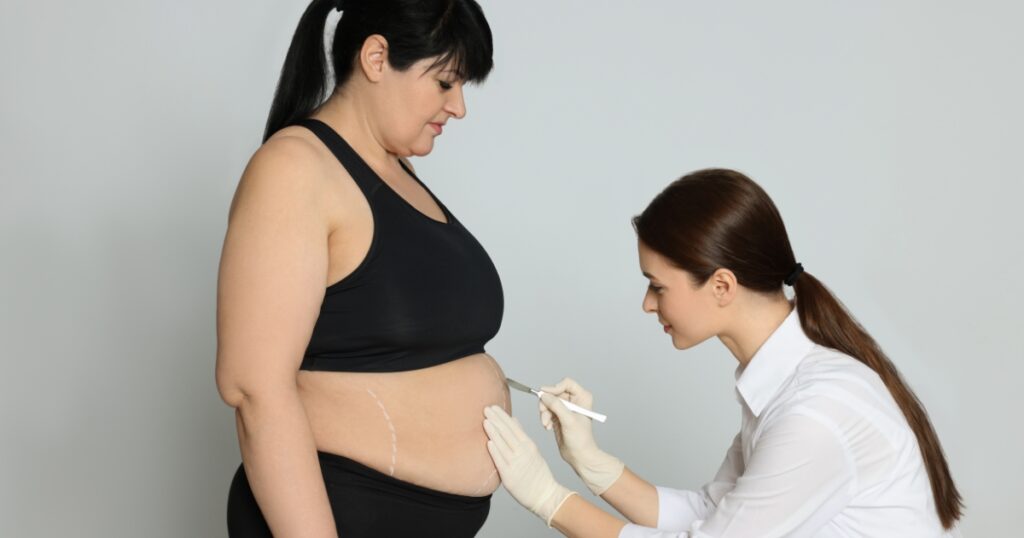 What Are The Potential Risks And Complications Of Liposuction Vs. Weight Loss Surgery