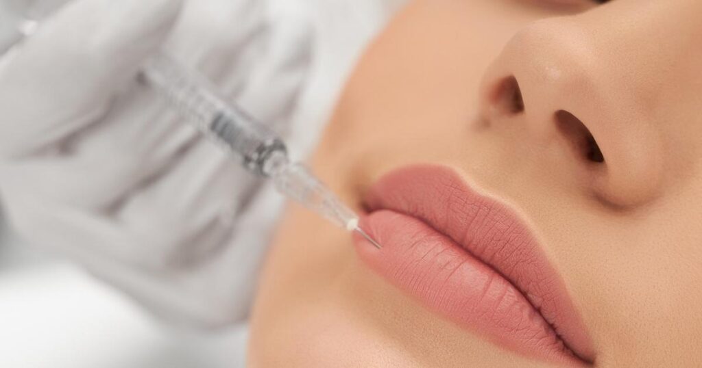 What Areas Of The Body Can Be Treated With Fillers