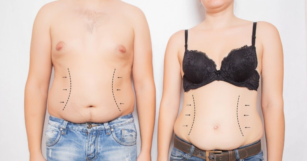What Are The Benefits Of A Second Tummy Tuck