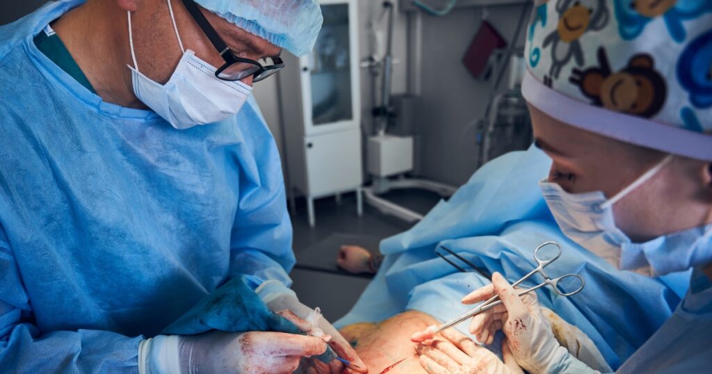 What Are The Potential Risks And Complications Of A Second Tummy Tuck
