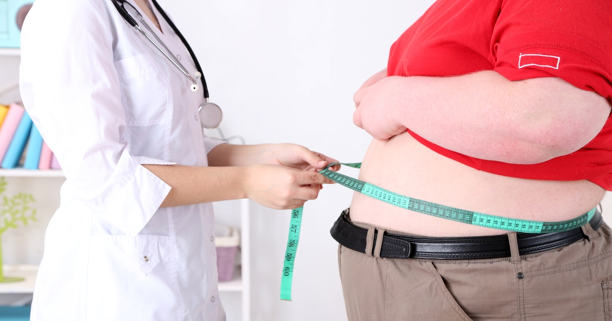 Liposuction Vs. Weight Loss Surgery For Morbid Obesity 2024