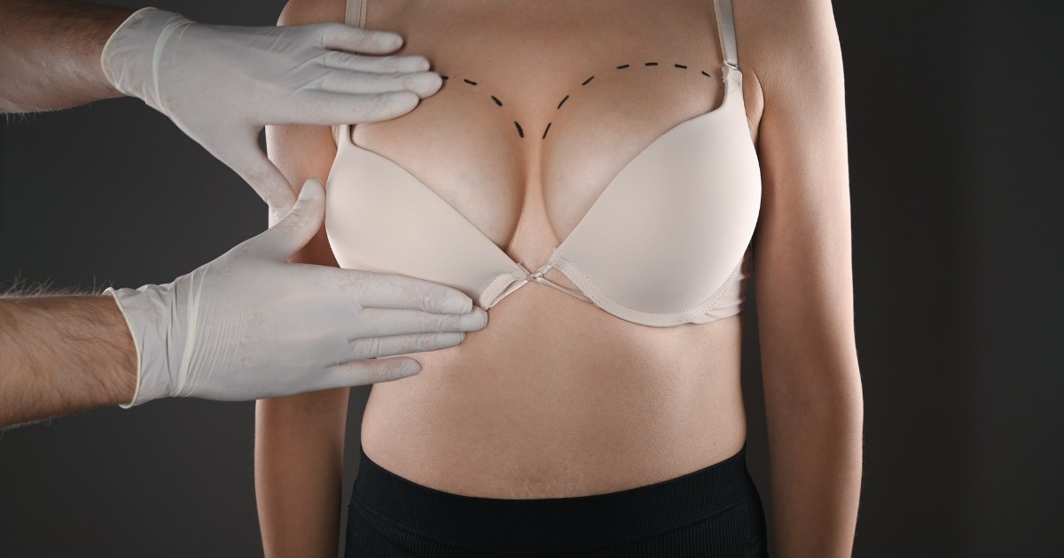 Achieving Desired Breast Size With 300cc Breast Augmentation 2024