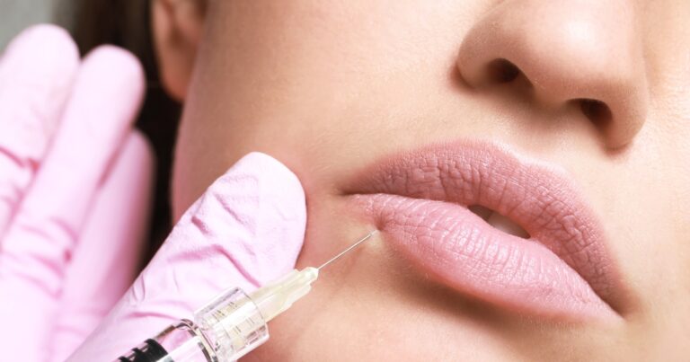 Botox Lip Flip: Get The Perfect Pout In Minutes
