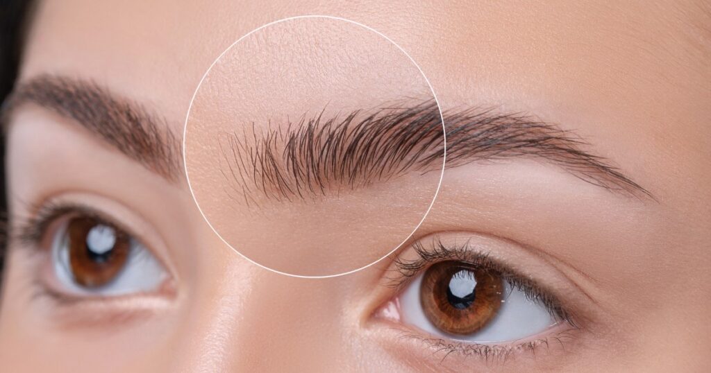 Can Botox Lift A Drooping Eyebrow To Match The Other