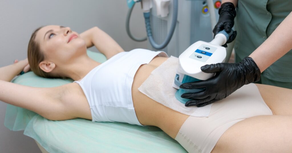 CoolSculpting