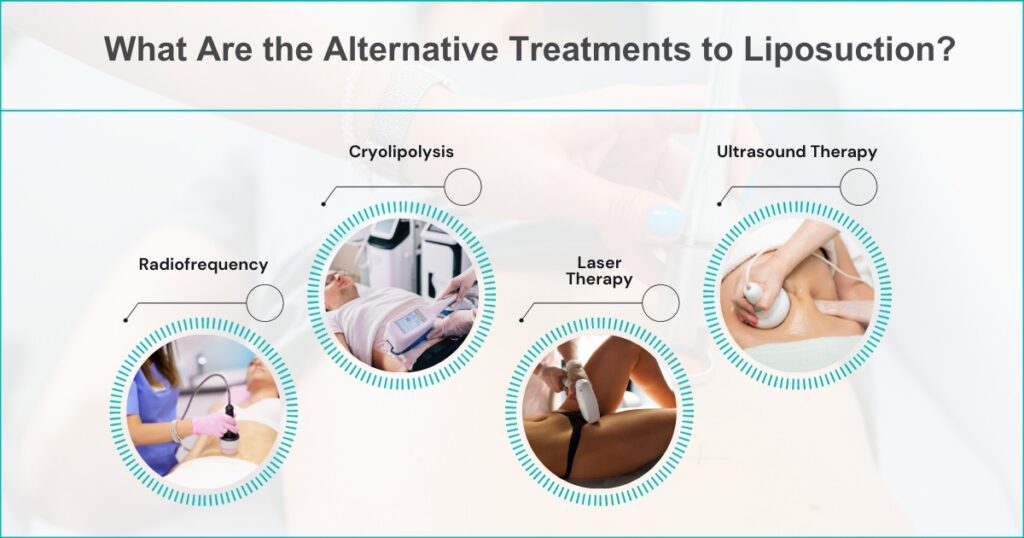 Exploring Alternative Treatments To Liposuction