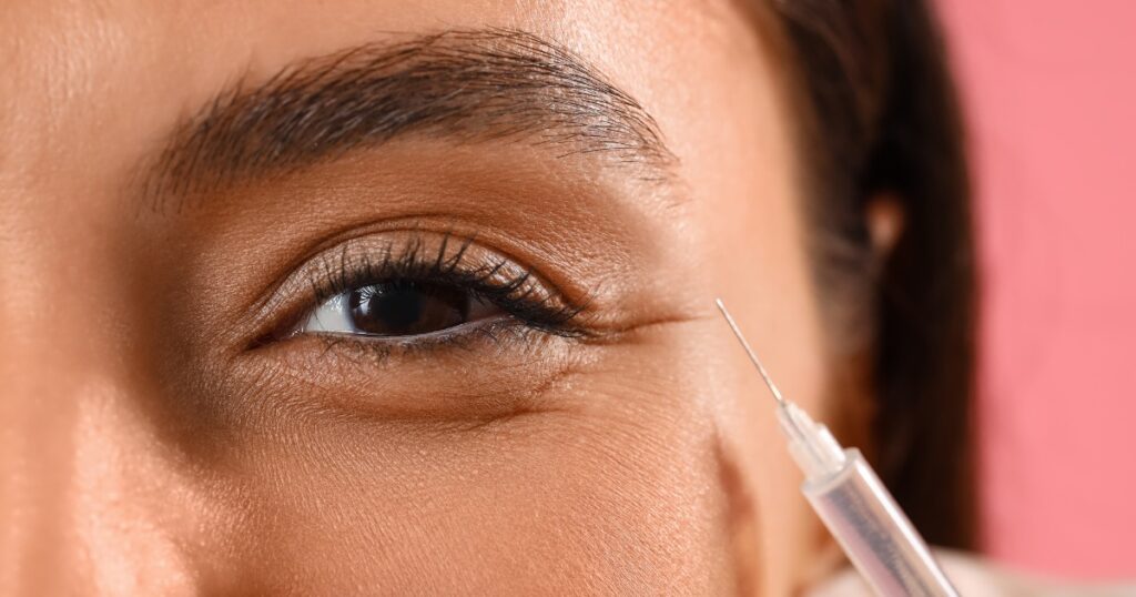 How Long Do Fillers Last For Wrinkles