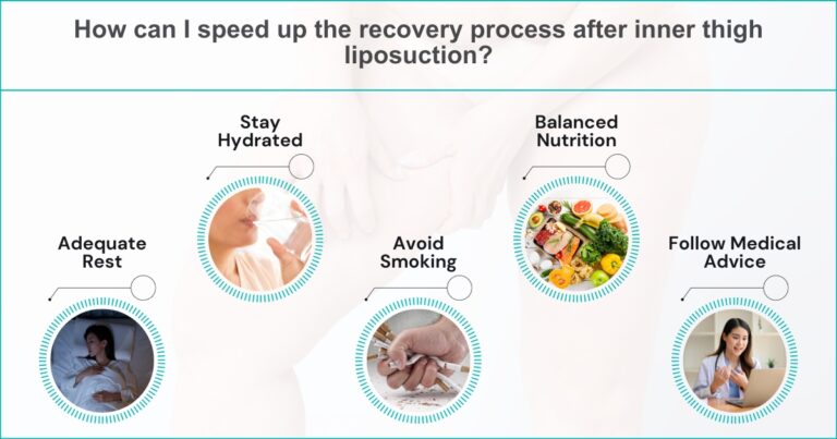 Inner Thigh Liposuction Recovery