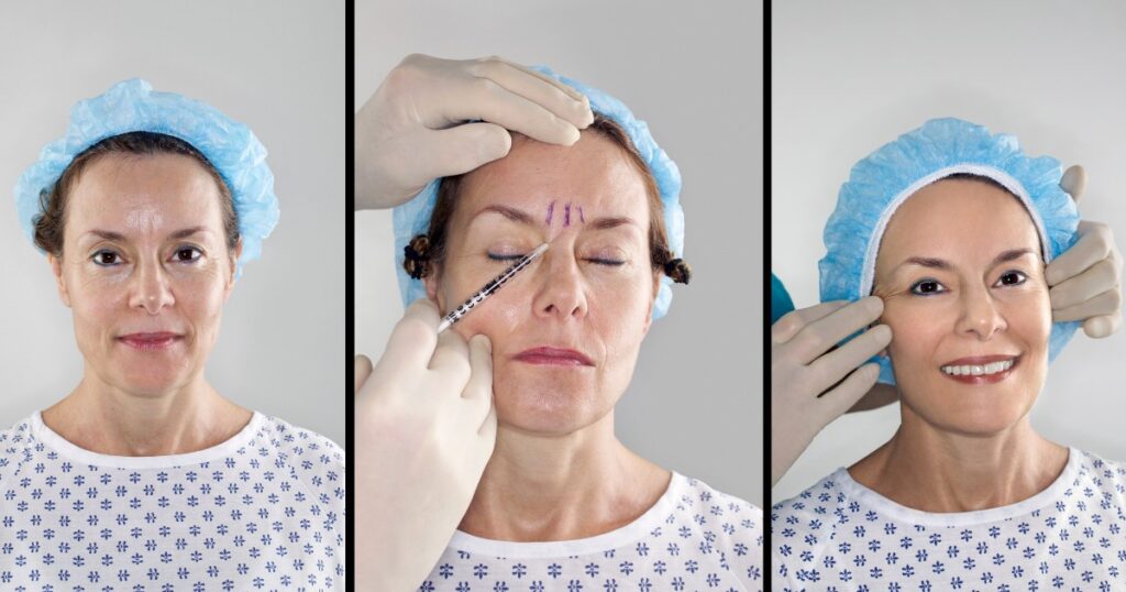 Is Botox Effective For Correcting Uneven Eyebrows