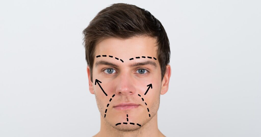Navigating Post-Procedure Life_ Maintenance And Long-Term Effects Of Facial Liposuction