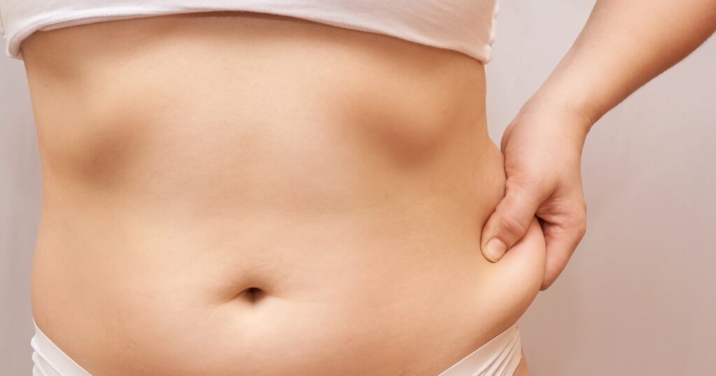 The Benefits And Limitations Of Liposuction In Medical Treatment