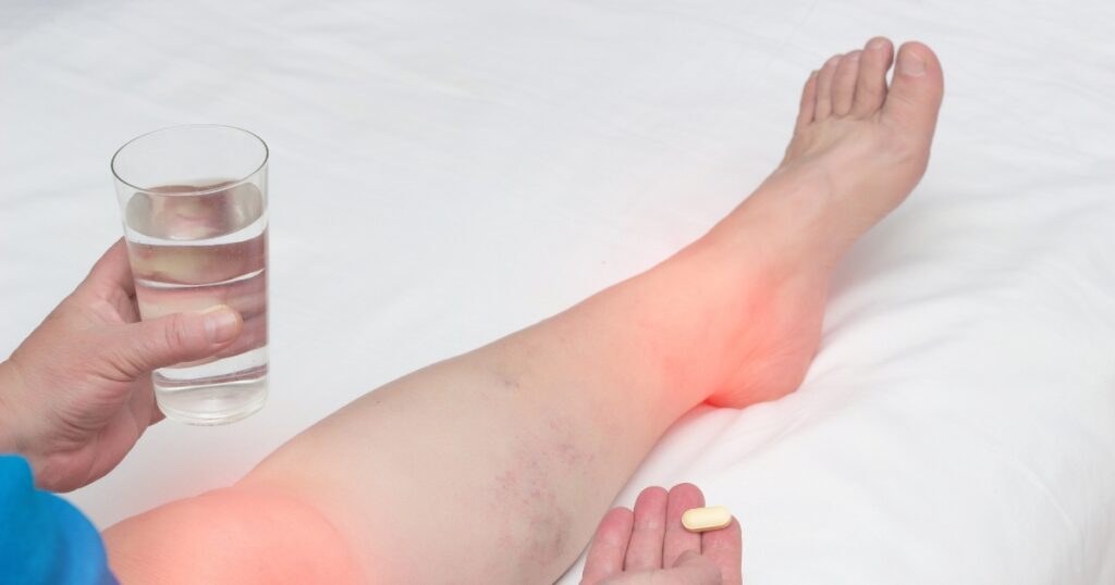 Tips For Reducing Swelling And Bruising