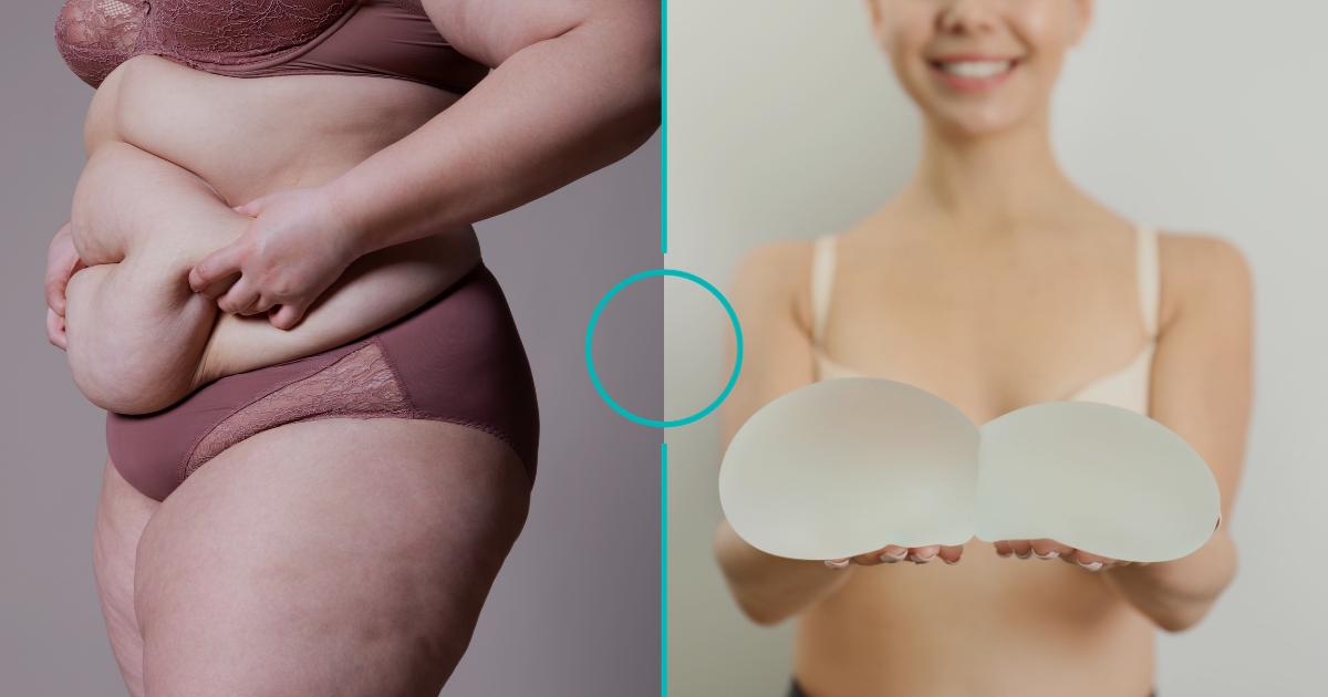 Tummy Tuck And Breast Augmentation_ The Perfect Pair For Body Contour Transformation