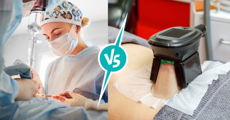 Tummy Tuck Vs. Coolsculpting: Which One Is More Effective
