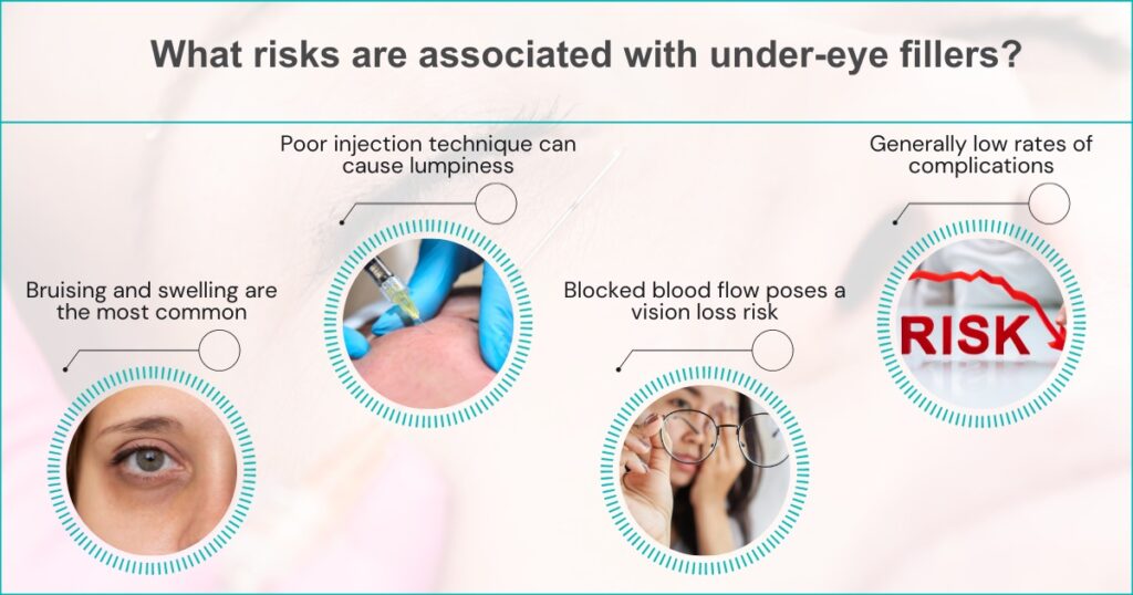 What Risks Are Associated With Under-Eye Fillers