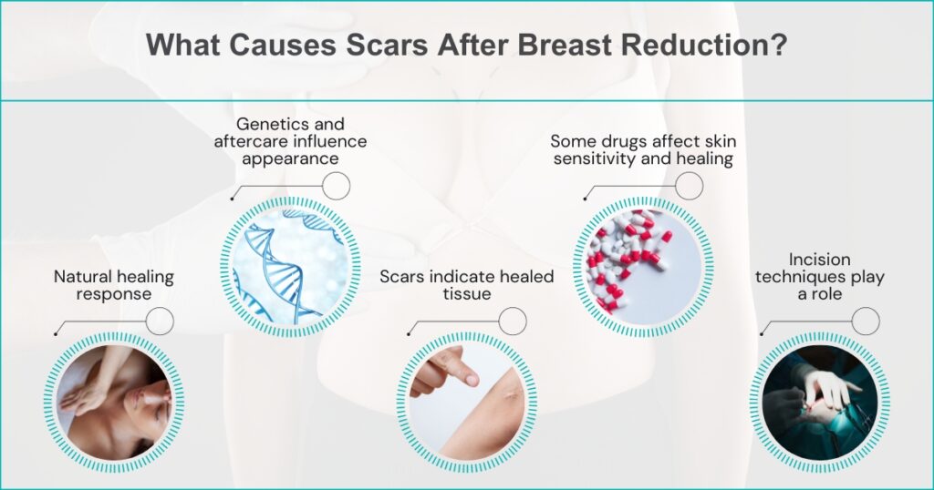 Why Do Scars Form After Breast Reduction