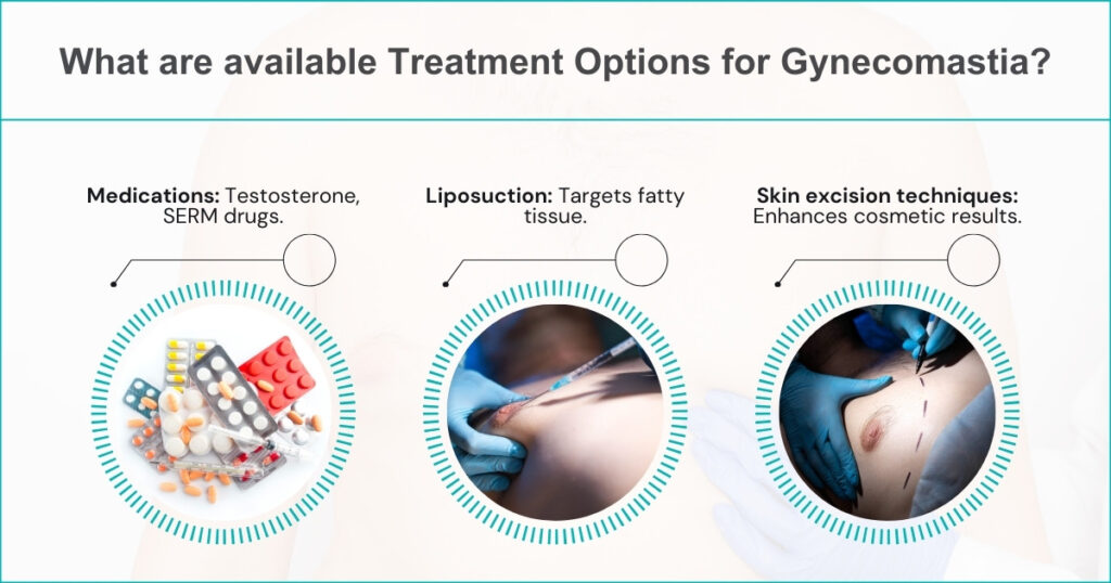 Available Treatment Options for Gynecomastia