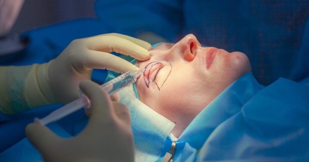 Does Eyelid Surgery Produce Permanent Results