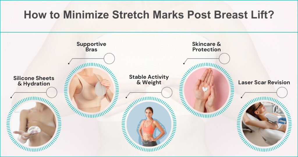 How can I minimise stretch marks after a breast lift