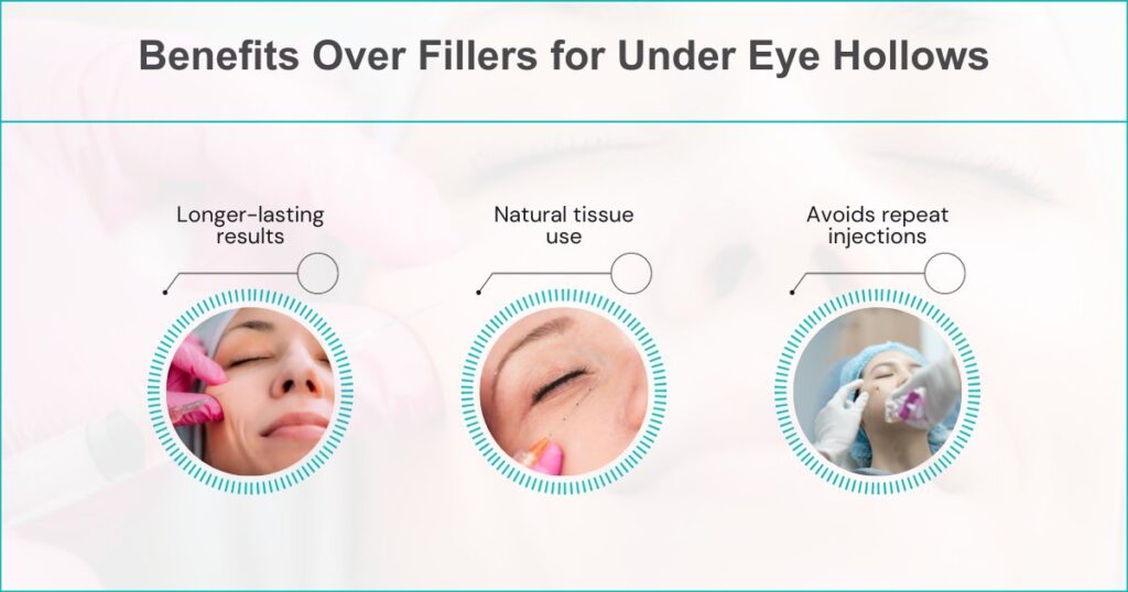 Benefits Over Fillers For Under Eye Hollows