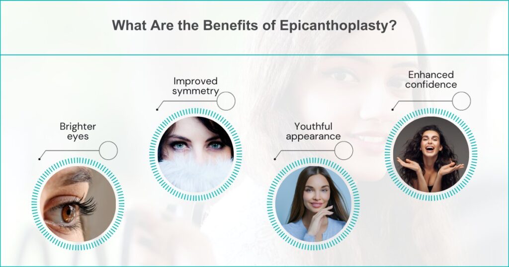 Benefits Of Epicanthoplasty