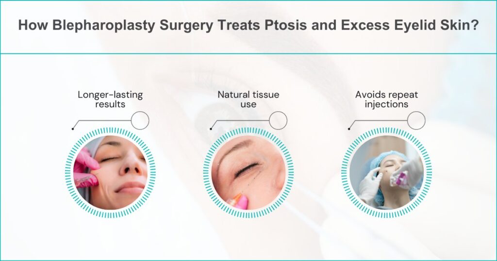 How Blepharoplasty Surgery Treats Ptosis And Excess Eyelid Skin