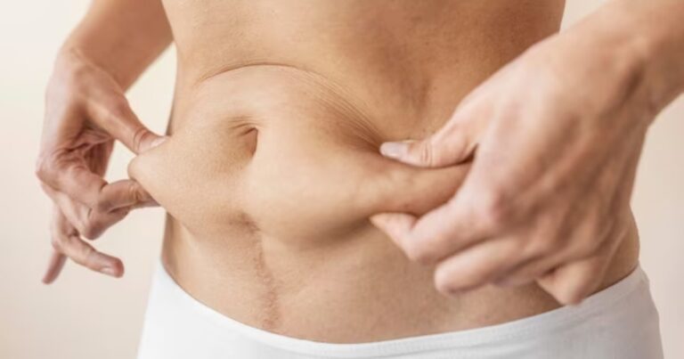 Liposculpture Side Effects: What You Need To Know