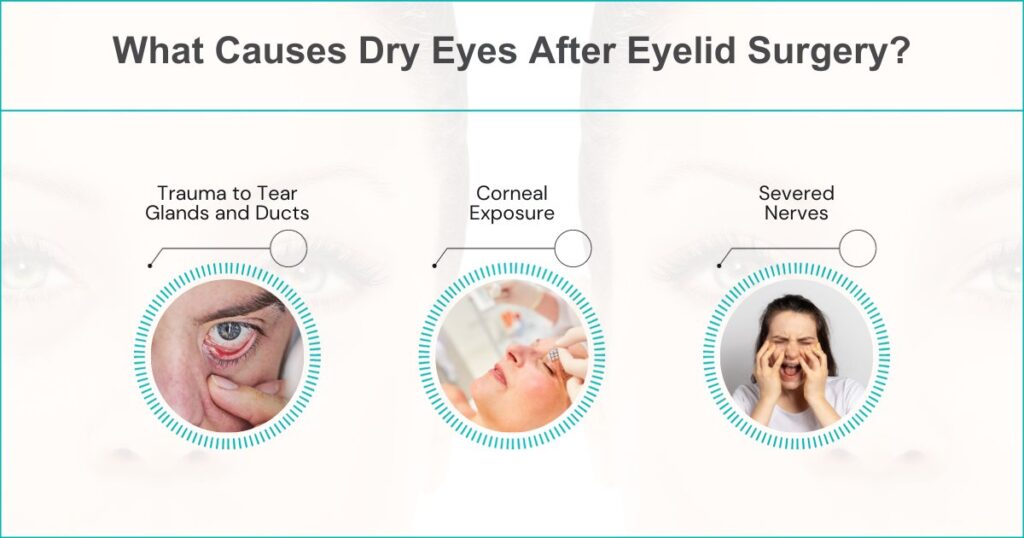 What Causes Dry Eyes After Eyelid Surgery