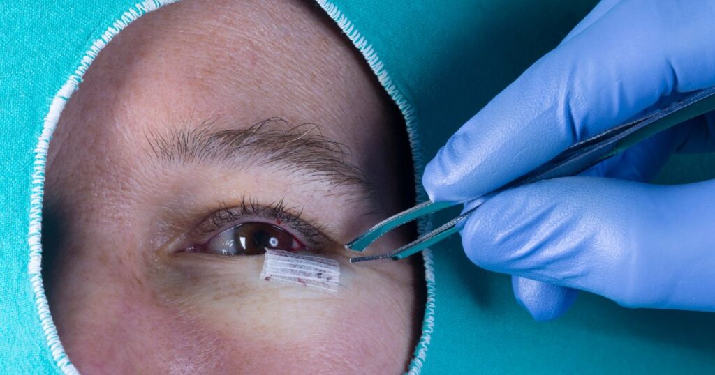 What Is Lower Eyelid Retraction Surgery? 2024