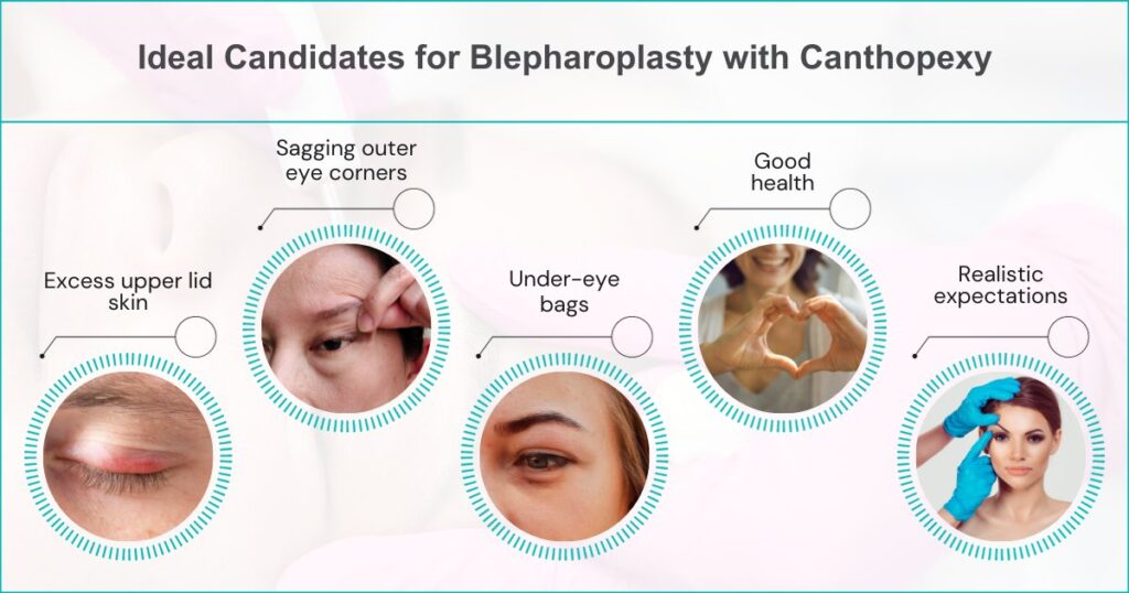 Who Is A Good Candidate For Blepharoplasty With Canthopexy