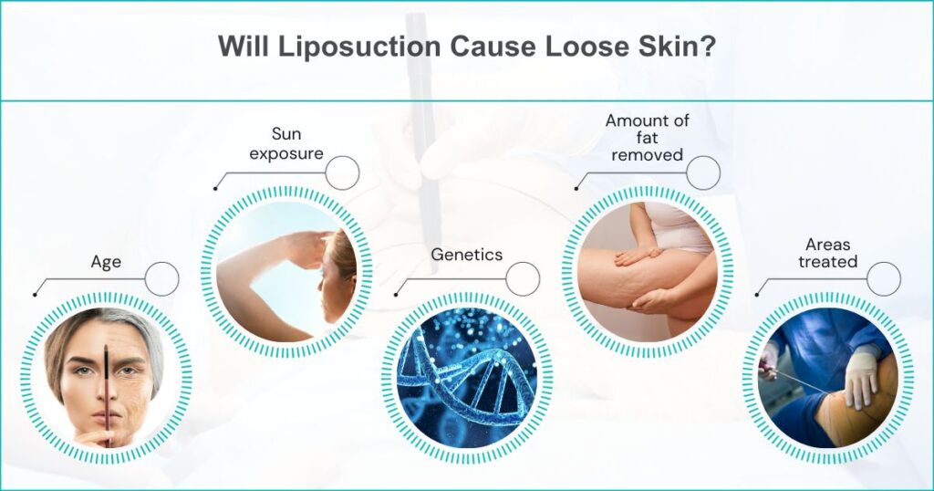 Does Liposuction Cause Loose Skin Does Liposuction Cause Loose Skin