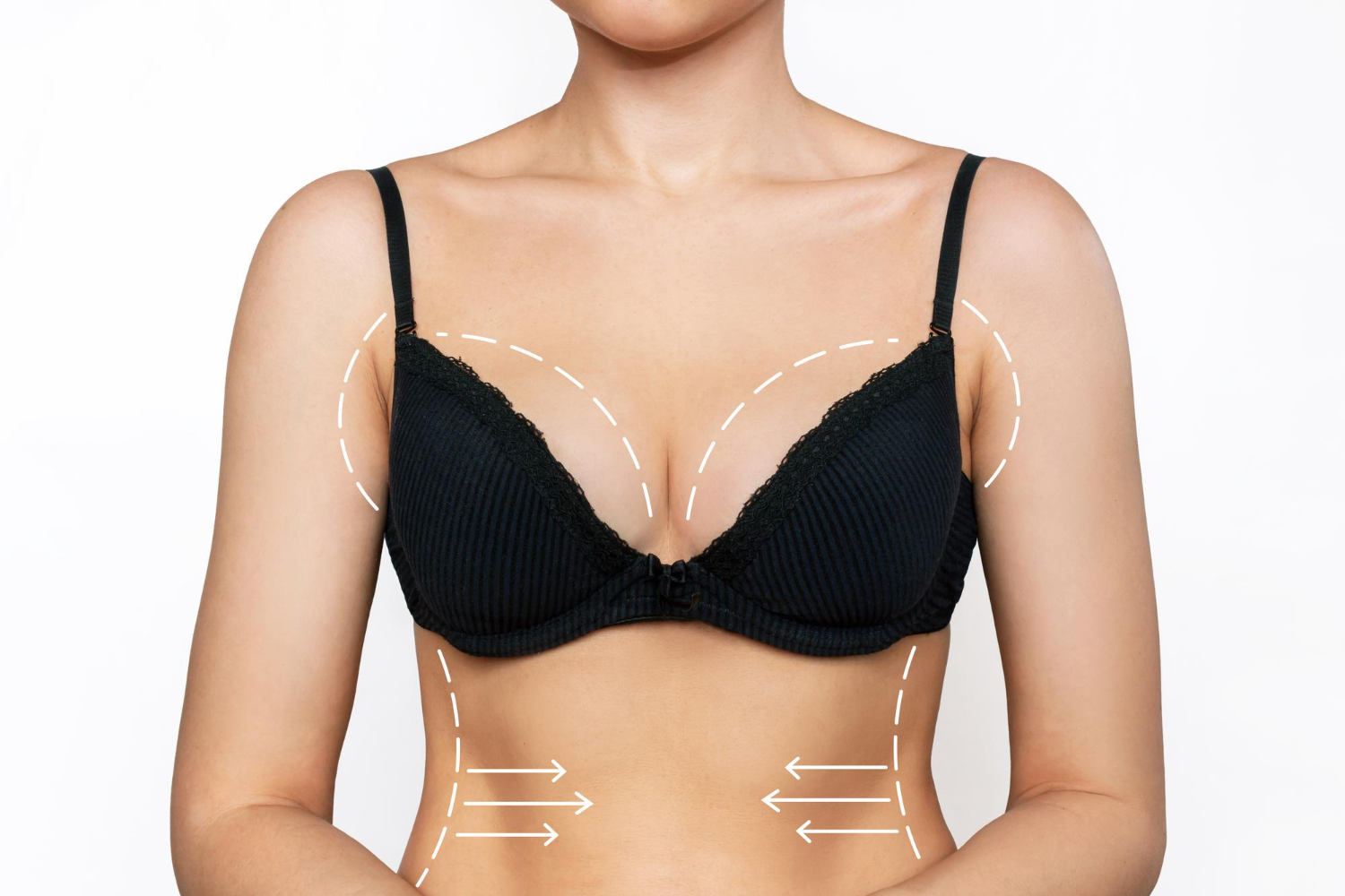 Breast Lift With Liposuction