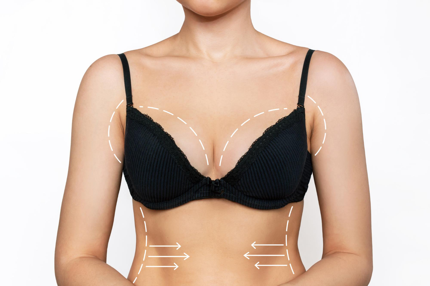 Breast Lift With Liposuction 2024