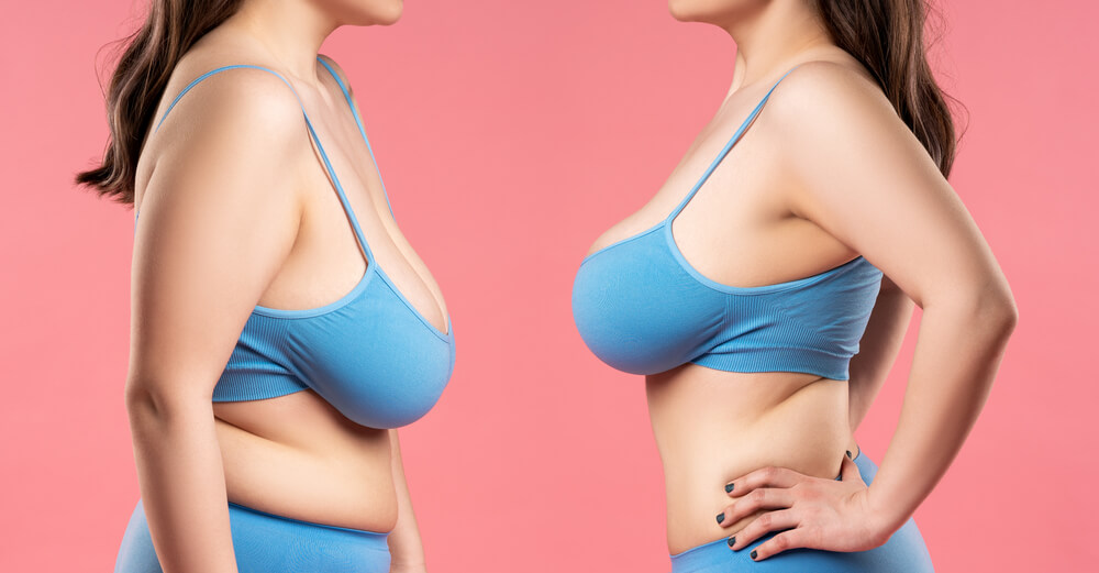 How To Lift Breast After Weight Loss?