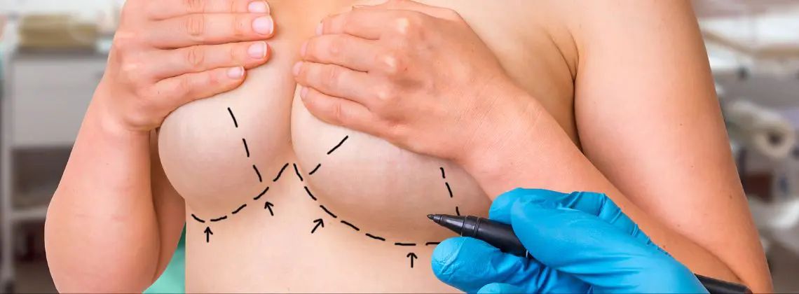 Is A Breast Lift A Major Surgery