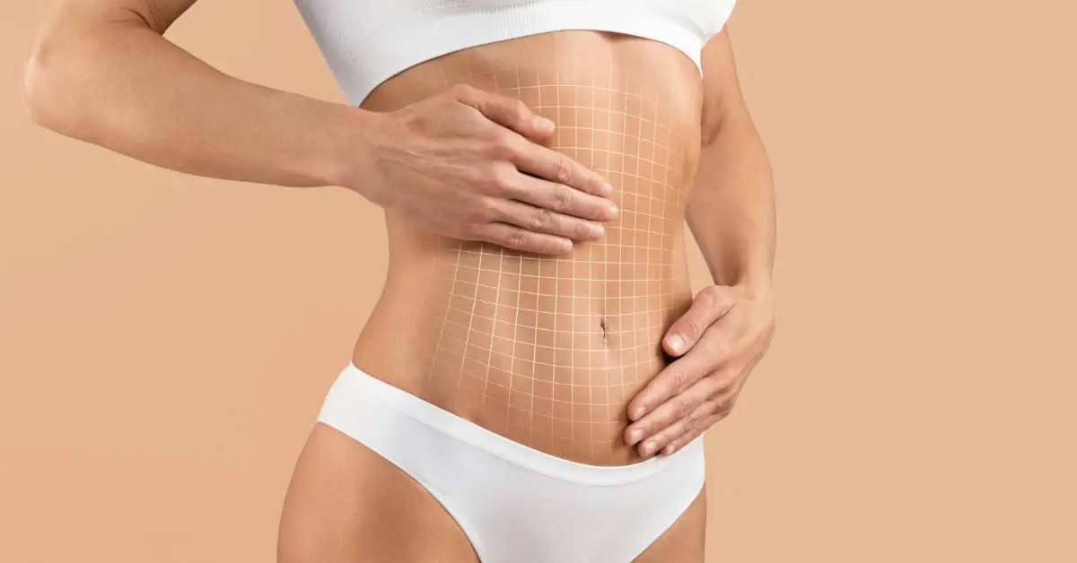 When To Get Liposuction: Your Ultimate Guide